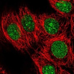 Invitrogen KCTD1 Polyclonal Antibody 100 &mu;L; Unconjugated:Antibodies,