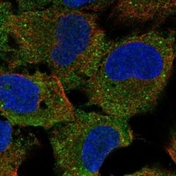 Invitrogen CCDC108 Polyclonal Antibody 100 &mu;L; Unconjugated:Antibodies,