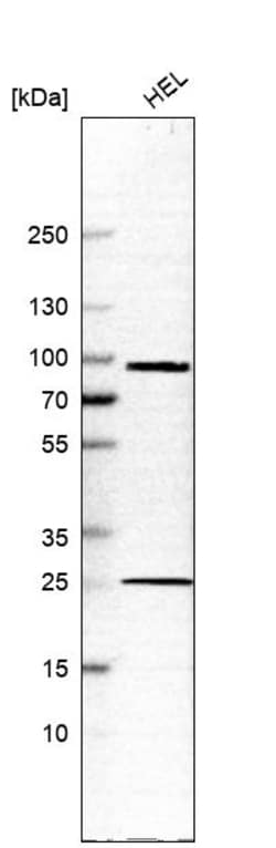 Invitrogen KELL Polyclonal Antibody 100 &mu;L; Unconjugated:Antibodies,