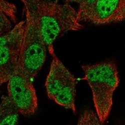 Invitrogen RDH8 Polyclonal Antibody 100 &mu;L; Unconjugated:Antibodies,