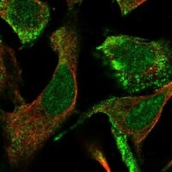 Invitrogen CLCA4 Polyclonal Antibody 100 &mu;L | Buy Online | Invitrogen&trade; | Fisher Scientific