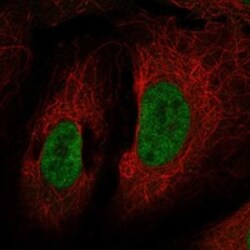 Invitrogen CHD9 Polyclonal Antibody 100 &mu;L | Buy Online | Invitrogen&trade; | Fisher Scientific