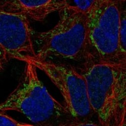Invitrogen ANKRD63 Polyclonal Antibody 100 &mu;L; Unconjugated:Antibodies,