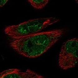 Invitrogen ADAMTS16 Polyclonal Antibody 100 &mu;L; Unconjugated:Antibodies,