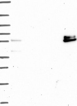 Invitrogen ADAMTS16 Polyclonal Antibody 100 &mu;L | Buy Online | Invitrogen&trade; | Fisher Scientific