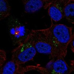 Invitrogen TRPM1 Polyclonal Antibody 100 &mu;L; Unconjugated:Antibodies,