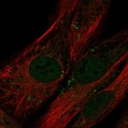 Invitrogen LRRC17 Polyclonal Antibody 100 μL; Unconjugated:Antibodies,