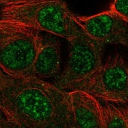 Invitrogen CMYA5 Polyclonal Antibody 100 &mu;L; Unconjugated:Antibodies,