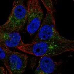 Invitrogen VAC14 Polyclonal Antibody 100 &mu;L; Unconjugated:Antibodies,