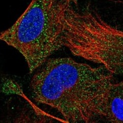 Invitrogen DHRSX Polyclonal Antibody 100 &mu;L; Unconjugated:Antibodies,