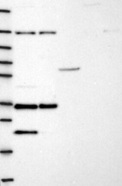 Invitrogen NGRN Polyclonal Antibody 100 &mu;L | Buy Online | Invitrogen&trade; | Fisher Scientific