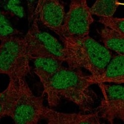 Invitrogen HMGXB4 Polyclonal Antibody 100 &mu;L; Unconjugated:Antibodies,