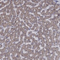 Invitrogen HPS5 Polyclonal Antibody 100 &mu;L; Unconjugated:Antibodies,