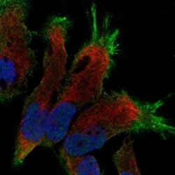 Invitrogen SLC4A8 Polyclonal Antibody 100 μL; Unconjugated:Antibodies,