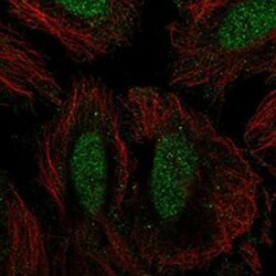 Invitrogen SIK1 Polyclonal Antibody 100 &mu;L; Unconjugated:Antibodies,
