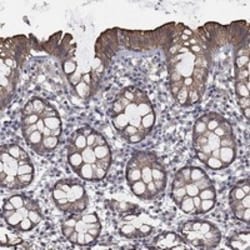 Invitrogen CHST5 Polyclonal Antibody 100 &mu;L; Unconjugated:Antibodies,