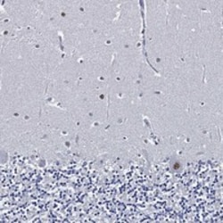 Invitrogen SKOR1 Polyclonal Antibody 100 &mu;L; Unconjugated:Antibodies,