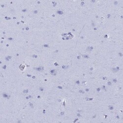 Invitrogen ApoA2 Polyclonal Antibody 100 &mu;L; Unconjugated:Antibodies,