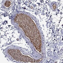 Invitrogen ApoA2 Polyclonal Antibody 100 &mu;L; Unconjugated:Antibodies,