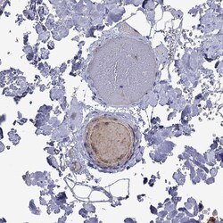 Invitrogen ApoA2 Polyclonal Antibody 100 &mu;L; Unconjugated:Antibodies,