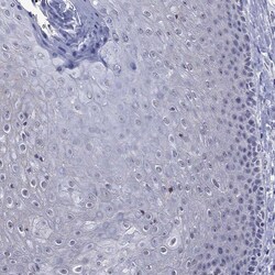 Invitrogen ApoA2 Polyclonal Antibody 100 &mu;L; Unconjugated:Antibodies,