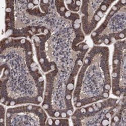Invitrogen MRPS24 Polyclonal Antibody 100 &mu;L | Buy Online | Invitrogen&trade; | Fisher Scientific