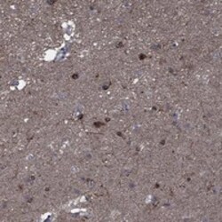 Invitrogen SLC44A1 Polyclonal Antibody 100 &mu;L; Unconjugated:Antibodies,