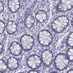 Invitrogen TRPM3 Polyclonal Antibody 100 &mu;L; Unconjugated:Antibodies,