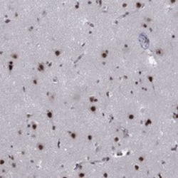 Invitrogen FYTTD1 Polyclonal Antibody 100 &mu;L; Unconjugated:Antibodies,