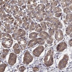 Invitrogen ALG6 Polyclonal Antibody 100 &mu;L | Buy Online | Invitrogen&trade; | Fisher Scientific