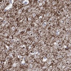 Invitrogen RIM1 Polyclonal Antibody 100 &mu;L; Unconjugated:Antibodies,