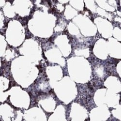 Invitrogen RHCE Polyclonal Antibody 100 μL; Unconjugated:Antibodies,