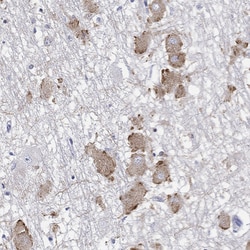 Invitrogen ECEL1 Polyclonal Antibody 100 &mu;L; Unconjugated:Antibodies,