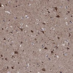 Invitrogen ZNF594 Polyclonal Antibody 100 &mu;L | Buy Online | Invitrogen&trade; | Fisher Scientific