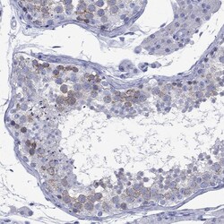 Invitrogen Cyclin A1 Polyclonal Antibody 100 μL; Unconjugated:Antibodies,