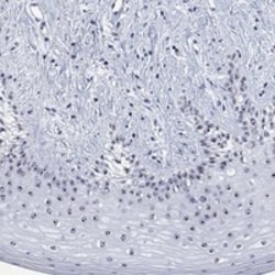 Invitrogen ZNF446 Polyclonal Antibody 100 &mu;L; Unconjugated:Antibodies,