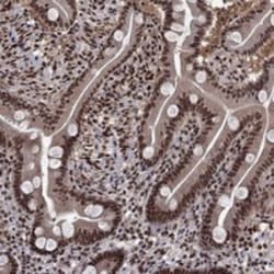 Invitrogen SAP30L Polyclonal Antibody 100 &mu;L; Unconjugated:Antibodies,