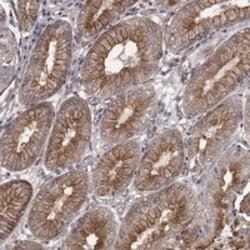 Invitrogen RASEF Polyclonal Antibody 100 &mu;L | Buy Online | Invitrogen&trade; | Fisher Scientific