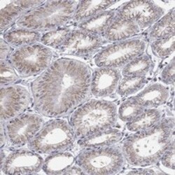 Invitrogen PANK3 Polyclonal Antibody 100 μL; Unconjugated:Antibodies,
