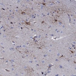 Invitrogen CLIP3 Polyclonal Antibody 100 &mu;L | Buy Online | Invitrogen&trade; | Fisher Scientific