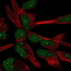 Invitrogen ZNF154 Polyclonal Antibody 100 &mu;L; Unconjugated:Antibodies,