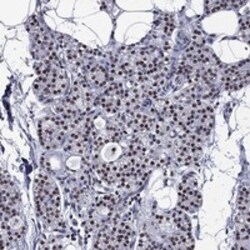Invitrogen ZNF154 Polyclonal Antibody 100 &mu;L; Unconjugated:Antibodies,
