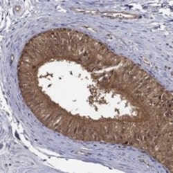 Invitrogen PSMG4 Polyclonal Antibody 100 &mu;L; Unconjugated:Antibodies,