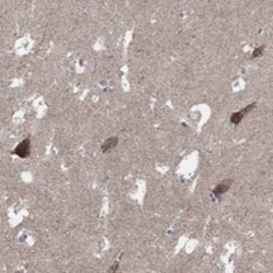 Invitrogen C9orf85 Polyclonal Antibody 100 &mu;L; Unconjugated:Antibodies,