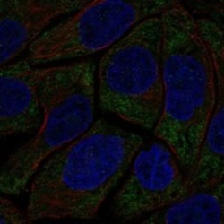 Invitrogen HECA Polyclonal Antibody 100 &mu;L; Unconjugated:Antibodies,