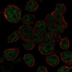 Invitrogen AHDC1 Polyclonal Antibody 100 &mu;L; Unconjugated:Antibodies,