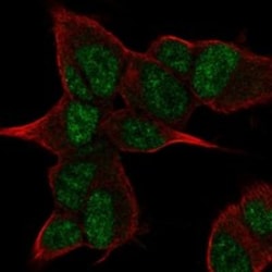 Invitrogen ANGEL2 Polyclonal Antibody 100 &mu;L; Unconjugated:Antibodies,
