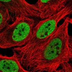 Invitrogen INO80 Polyclonal Antibody 100 &mu;L; Unconjugated:Antibodies,