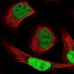 Invitrogen NCAPG2 Polyclonal Antibody 100 &mu;L; Unconjugated:Antibodies,