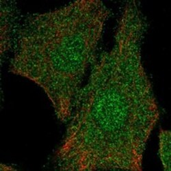 Invitrogen ELP5 Polyclonal Antibody 100 &mu;L; Unconjugated:Antibodies,